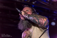 ChildBite-Smalls-Hamtramck_MI-20150731-ChuckMarshall-010